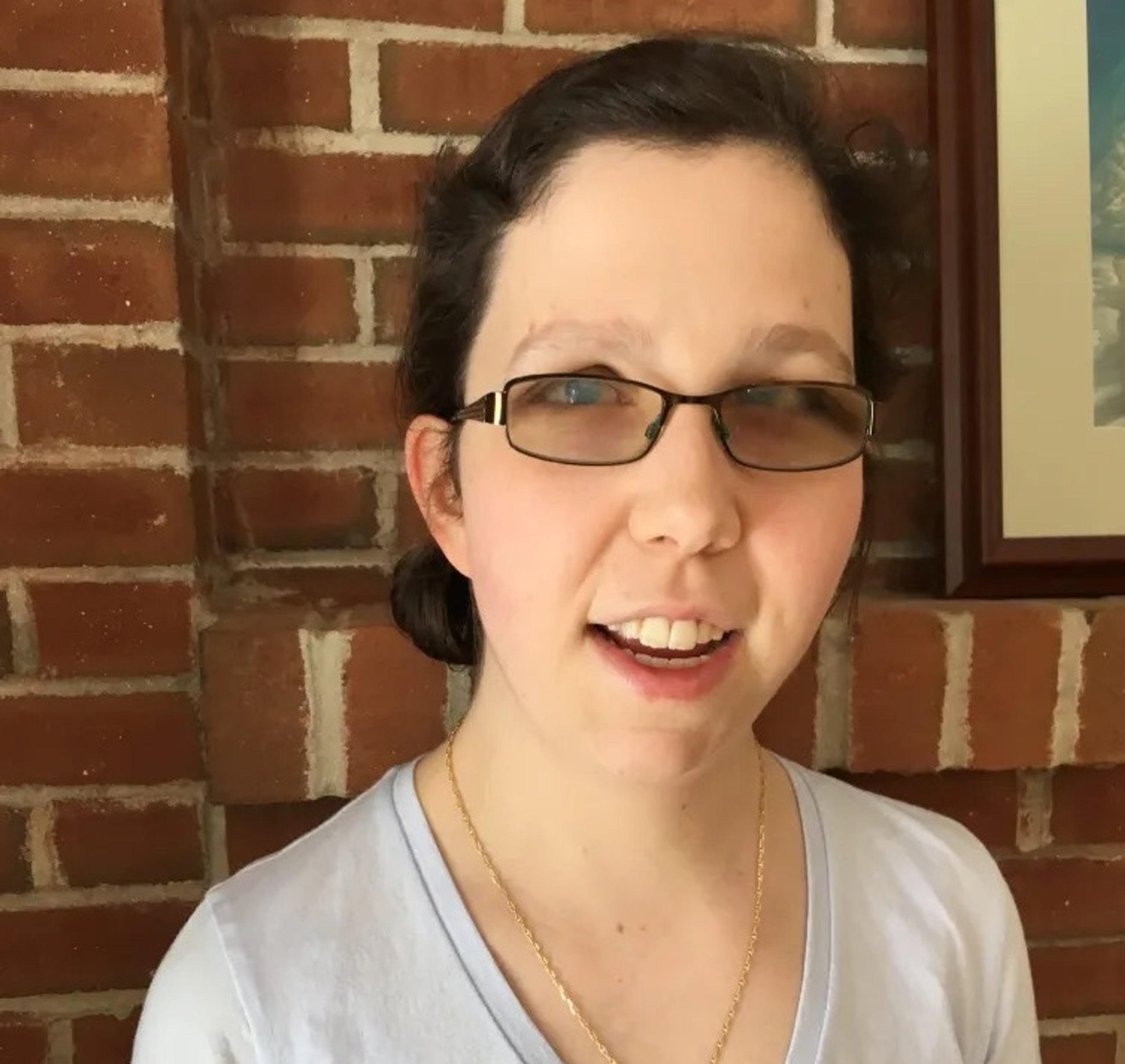 Placeholder alt text