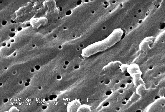 Vibrio cholerae (cholera) bacteria as seen under electron microscope. Photo: Pixnio.
